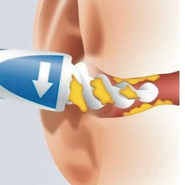 Easy Earwax Remover - Image 3